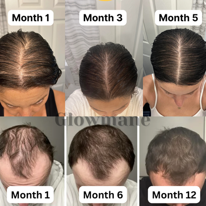 Glowmane Rapid Growth Roll On Formula