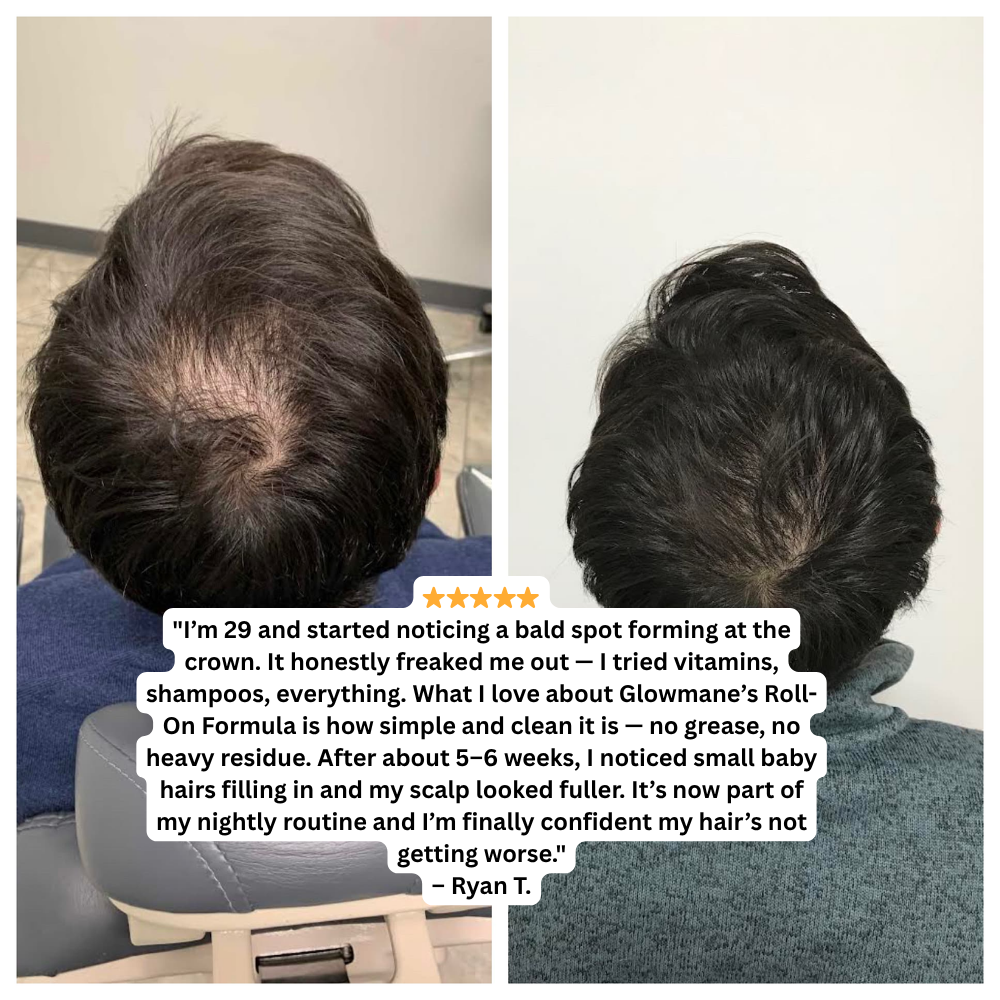 Glowmane Rapid Growth Roll On Formula