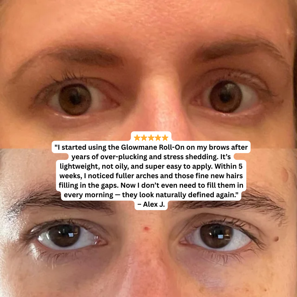 Glowmane Rapid Growth Roll On Formula