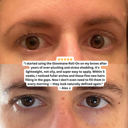 Glowmane Rapid Growth Roll On Formula